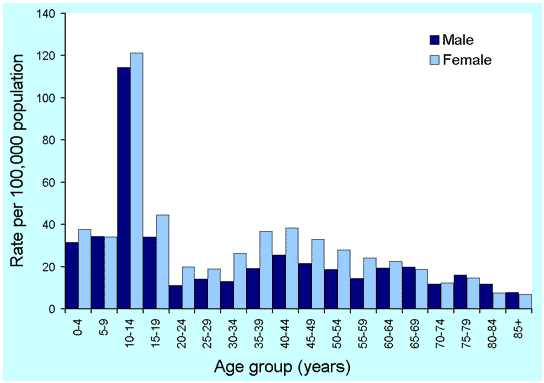 Figure 37. Notification rates of pertussis, Australia, 2000, by age and sex