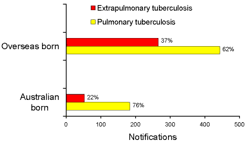Tuberculosis notifications, site of disease by Australian and overseas born status, 1996