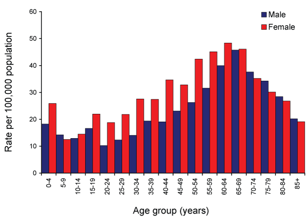 Figure 43:  Notification rate for pertussis, Australia, 2007, by age and sex