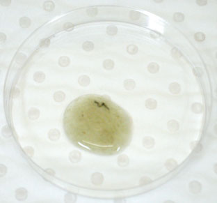 Figure 1. Photograph of patient's stool sample