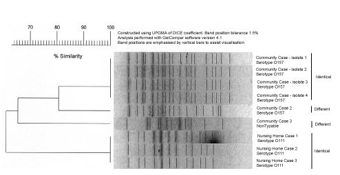 Figure. Dendogram of Pulsed Field Patterns of STEC isolates from a community cluster and a nursing home cluster
