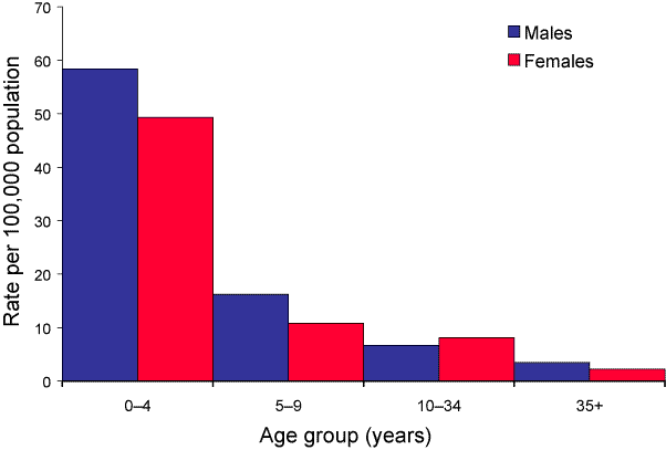 Figure 34. Varicella hospitalisation rates, Australia, July 2000 to June 2002, by age group and sex