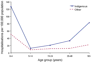 Figure 5. Hospitalisation rate for influenza, Australia, 1999 to 2002, by age group and Indigenous status